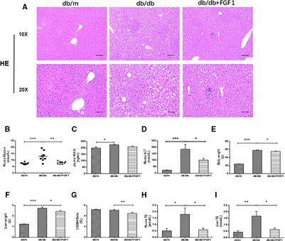 Fibroblast Growth Factor 1 Ameliorates Diabetes-Induced Liver Injury by Reducing Cellular Stress and Restoring Autophagy